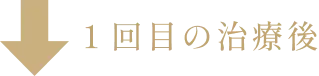 BEFOREからAFTERへの矢印